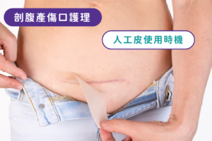 傷口敷料怎麼挑？人工皮用在哪？剖腹產傷口護理看這篇