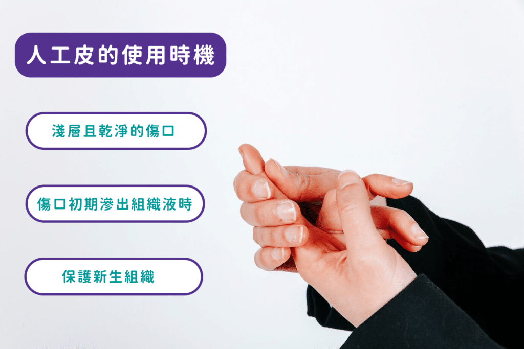 人工皮的使用時機有哪些？