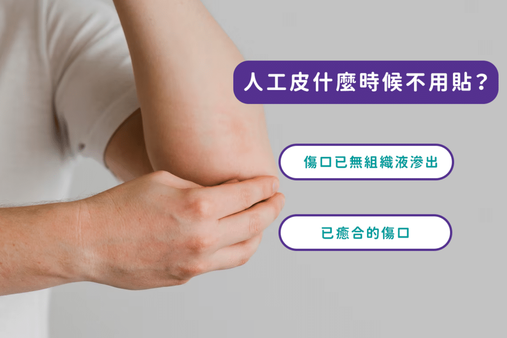 人工皮什麼時候不用貼？