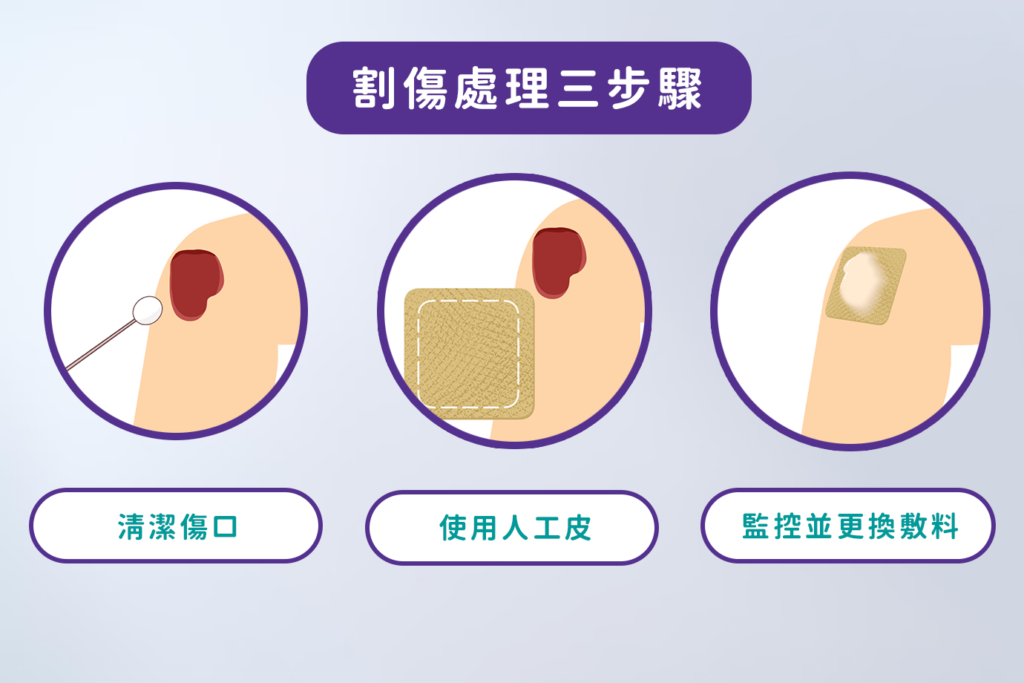 割傷處理正確3步驟