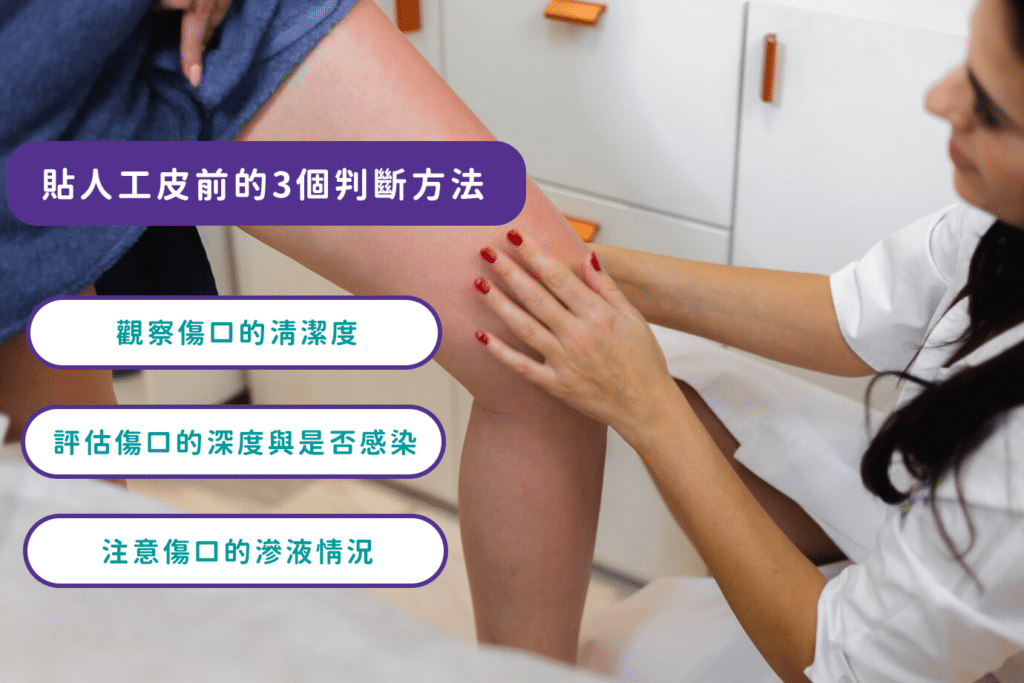 貼人工皮要擦藥嗎？3個判斷方法讓你避免錯誤用法