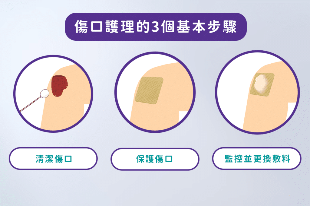 傷口護理的3個基本步驟