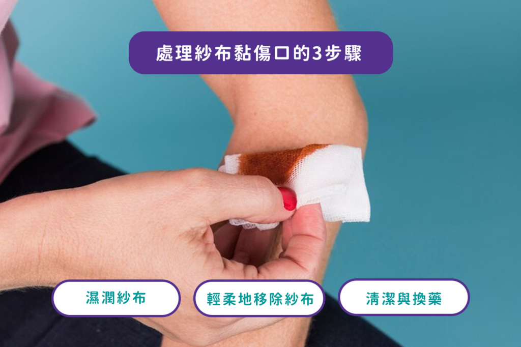 紗布黏傷口處理3步驟