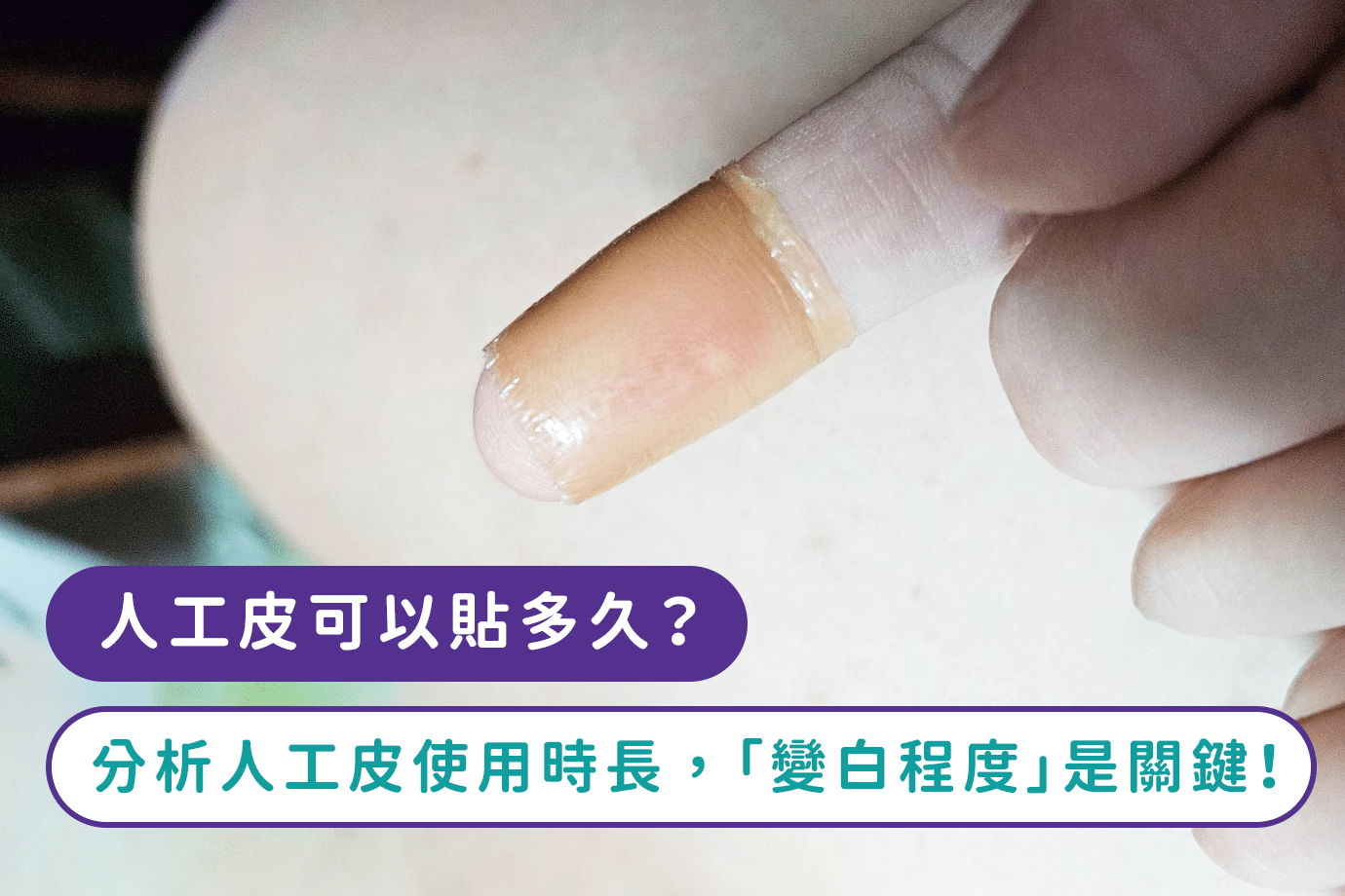 人工皮可以貼多久？