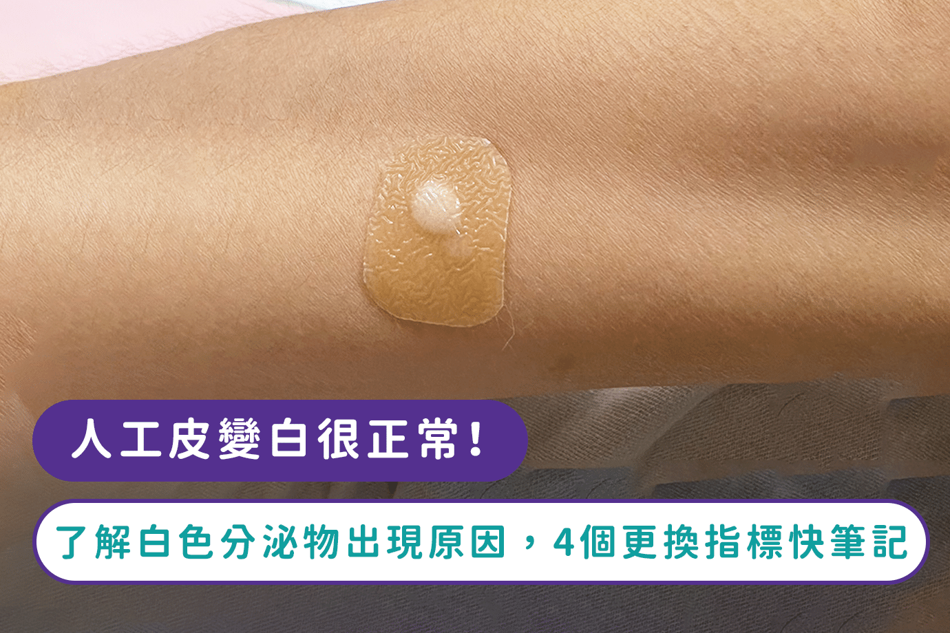 人工皮變白很正常