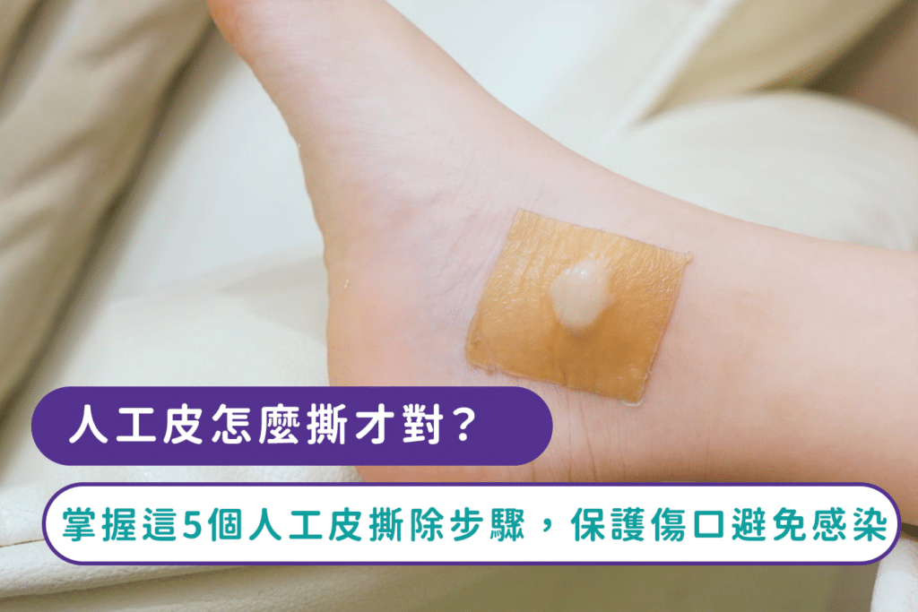 人工皮怎麼撕